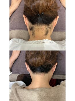 スマイルネイル(SMILE NAIL)/