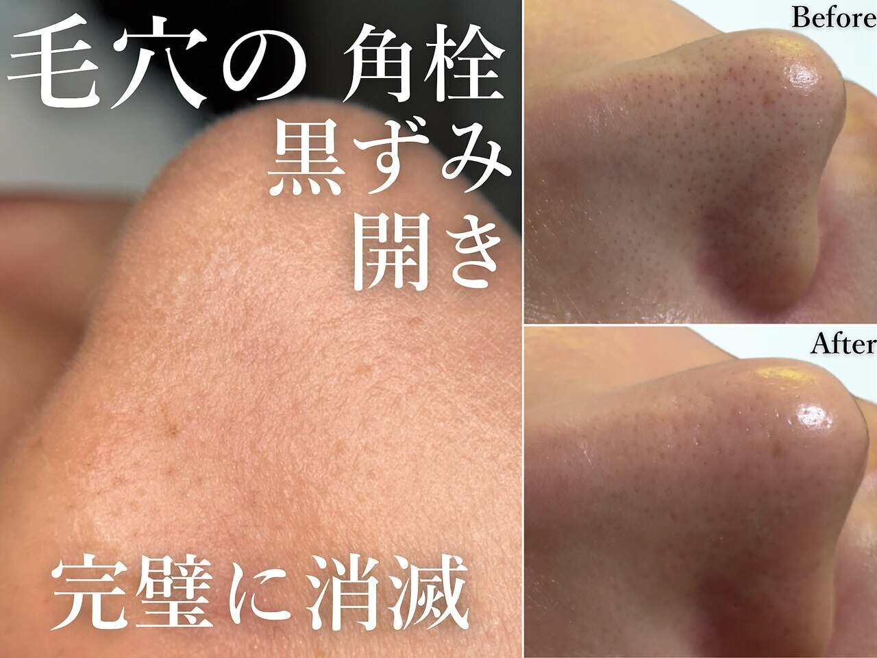 キャンディ 天王寺(CANDi)｜ホットペッパービューティー