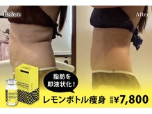 アネル 美里店(anel)の雰囲気（韓国希少！ついに脂肪分解レモンボトル登場!今なら初回7800円）