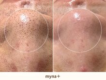 マイナプラ 表参道(myna+)/