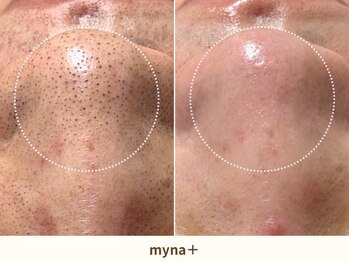 マイナプラ 表参道(myna+)/