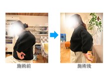 さくらの整体院の雰囲気（５０代女性・肩の痛みが軽く可動域もUP）