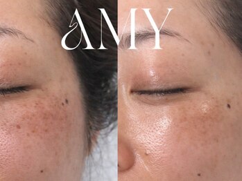 エイミー(Amy)/【Before/After】