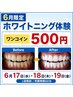 【6/17水・18木・19金 初回限定】3日間のみ!500円ホワイトニング体験♪