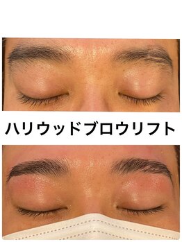 レヴィオ(REVIO)/ハリウッドブロウリフト