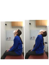 コアバランス整体院/肩こり【O脚矯正/亀戸/錦糸町】