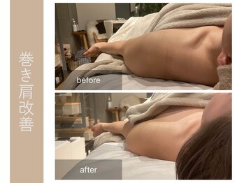 ジョルネ 中目黒(jornee.)/before/after