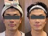 【男性】肌悩みご相談　フェイシャルコース　