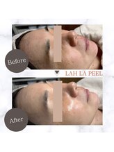 ルームエイトエイティスリー 新宿(R883)/ララピール　before→after