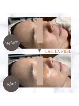 ルームエイトエイティスリー 新宿(R883)/ララピール　before→after