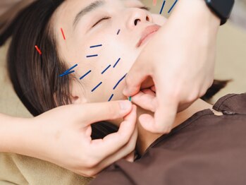 ミラー(mirror)の写真/【美容鍼をもっと身近に】内側から美しく弾力のあるぷるぷる肌に☆むくみ改善にも◎是非一度お試し下さい♪