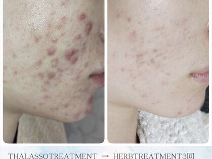 ティアス(t-us)の写真