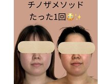 ルース(LUCE)の雰囲気（「エラ張り、骨かと思ってました」ここまで変わる小顔メソッド）
