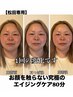 ７月限定《松田専用》顔を触らず小顔リフトアップ+上半身リンパ+ご褒美パック
