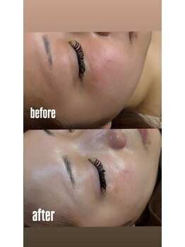 ロアーク 博多口店(LOARK)/ララピール