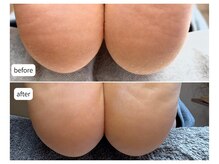 カシェット(Cachette)/30代女性◎足裏角質ケア90分