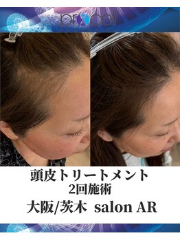 メンズサロンアール(AR)/プロセルセラピーズ