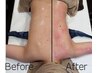 【内出限定！肩中筋膜剥がしで身体スッキリ】ダイエット効果も◎ 60分7000円