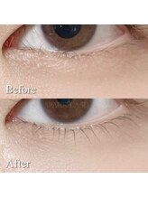 スパークラッシュ(SPARK LASH)/下まつげパーマ