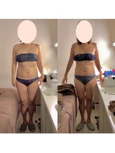 アクア エステティコ 亀有(ACQUA estetico)/中半身痩身　6回