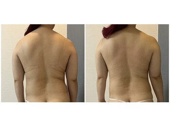 モア(moa)/症例写真