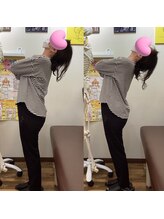 ヒデ整体院(Hide整体院)/猫背矯正骨盤矯正B/A肩こり腰痛