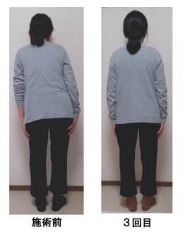 整体処たまゆら/体の歪み・傾きビフォーアフター