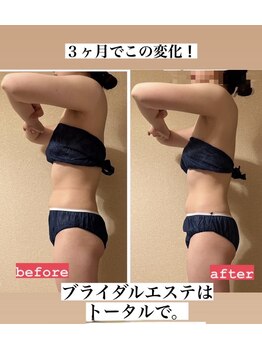 ヨサパーク ハット(YOSA PARK HAT)/ブライダルエステにも☆