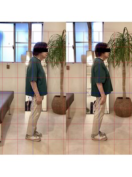 ドクターキュア 戸越店(DR.CURE)/整体ビフォーアフター