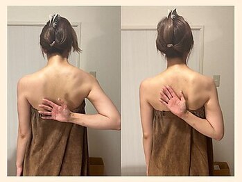 【肩こり/リンパマッサージ/小顔/ヘッドスパ】肩甲骨はがし肩こり整体RUFFREE高尾院/猫背/巻き肩姿勢改善に姿勢矯正