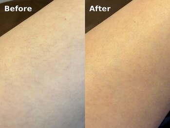 フォクシーワックス 立川店(FOXY WAX)/【ビフォーアフター】脚