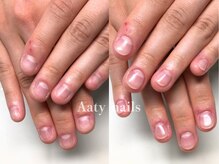 アーティネイルズ(Aaty Nails)/【深爪矯正】ハンド