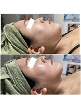 プリマプリート 可児店/サーマウェーブの1回の結果！！