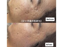 ベリスユイット(BELLIS HUIT)