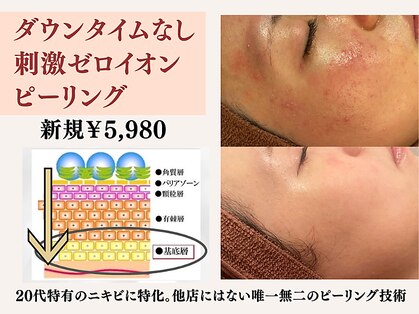 アクール(Accueil)の写真