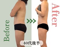 アムール(Amour)/下腹/ウエストスッキリ！｜40代