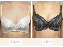 ノルン(Norn)の雰囲気（3回施術★ボリュームUPはもちろん、形も整え美乳に！）