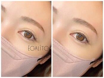 エガリテ(EGALite)/ハリウッドブロウリフト