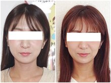 美容整体 ウェリナ 蟹江院/小顔矯正/骨盤矯正/美脚サロン