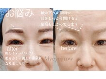 ヴィクトリア アイ(victoriaeye)