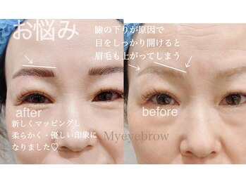 ヴィクトリア アイ(victoriaeye)