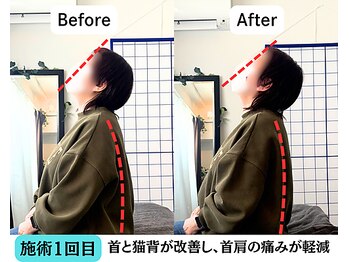 整体院 爽良/【札幌/大通り】首肩こり
