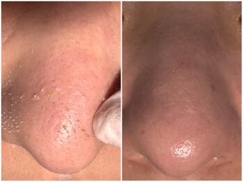 サラグランデ(Sara Grande)/イベント前のお手入れに!