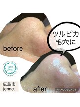 ジェンヌ(jenne.)/ツルン肌目指したい方へ