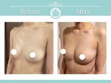 美人バスト 浜松店/◇ バストアップ &nbsp;BeforeAfter◇