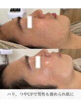 シロ(silo)/男性だって美肌になりたい