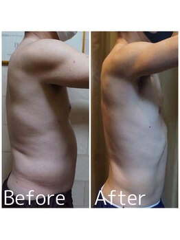 クイーン 熱海店(Queen)/お腹の脂肪は○○で減少します