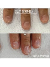 ピピ(PiPi)/【深爪育成】