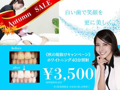 ホワイトニングショップ 熊谷店の写真