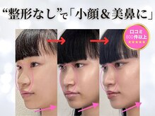 医療関係者と考案した独自メソッド、完全手技のみで、この変化☆